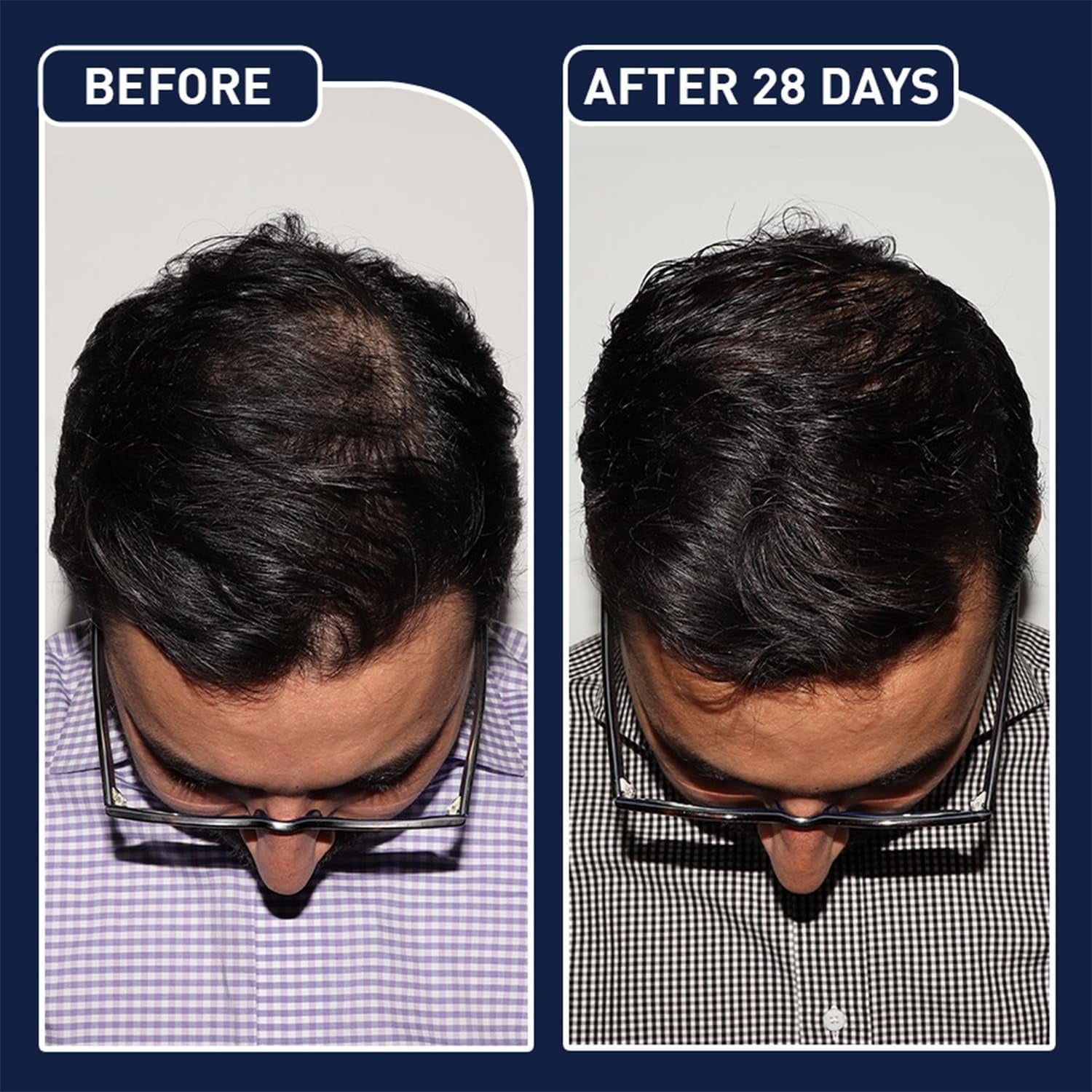 FEGPlus Beard & Hair Growth Serum